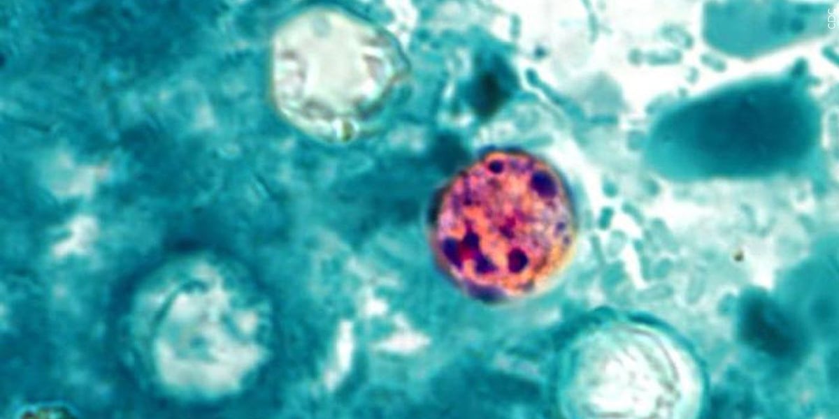 Cyclosporiasis: what to know about the parasite found in produce