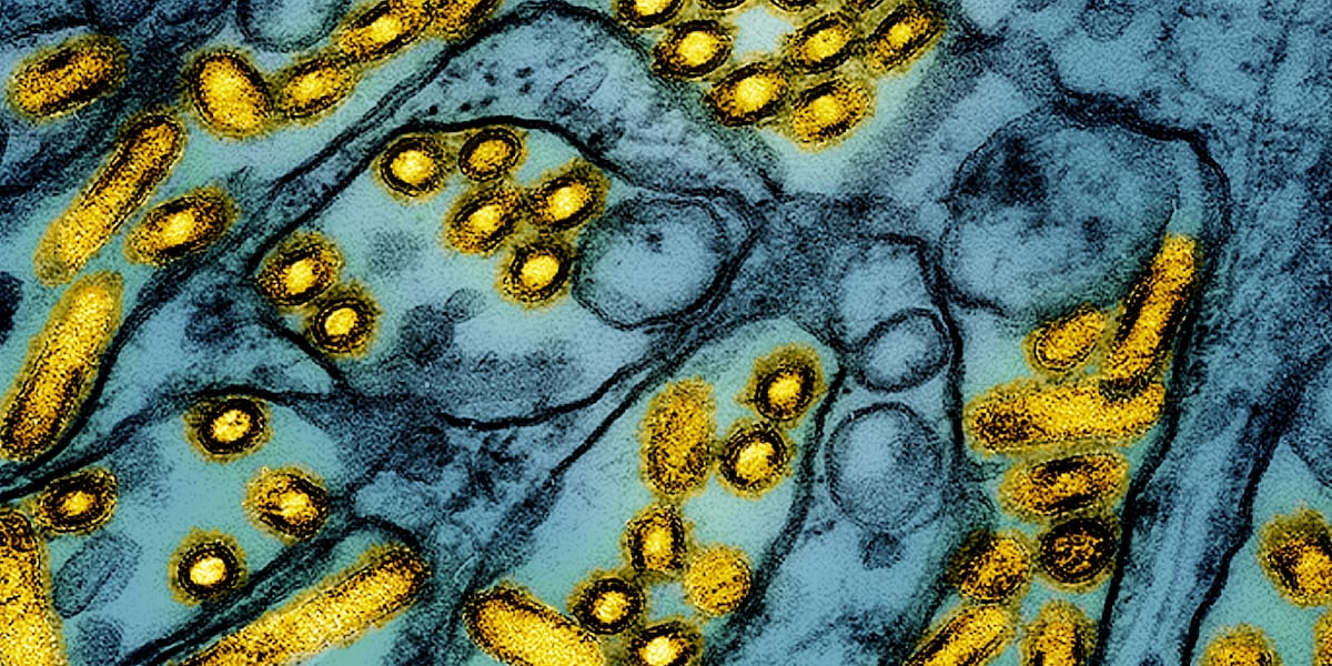 First human case of avian influenza in Iowa confirmed First human case of avian influenza in Iowa confirmed