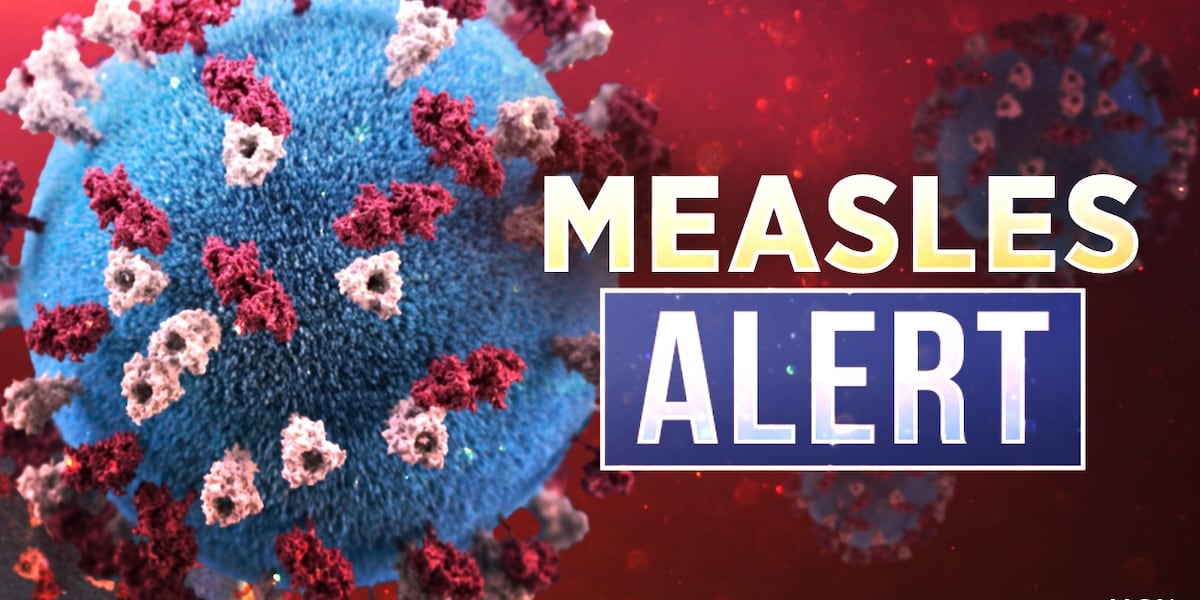 Measles case confirmed in eastern Iowa - KCRG