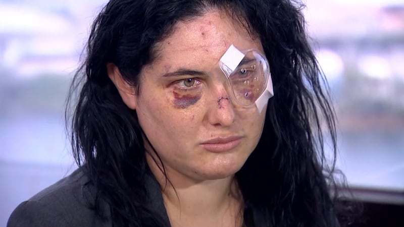 Caitlin Dydzuhn was attacked in an apparent random fit of rage while walking her dog outside...