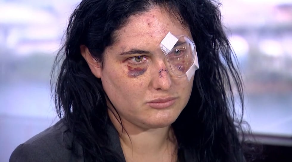 Caitlin Dydzuhn was attacked in an apparent random fit of rage while walking her dog outside...