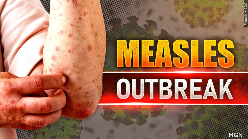 Wisconsin Map Star New measles case confirmed in Wisconsin, health officials say