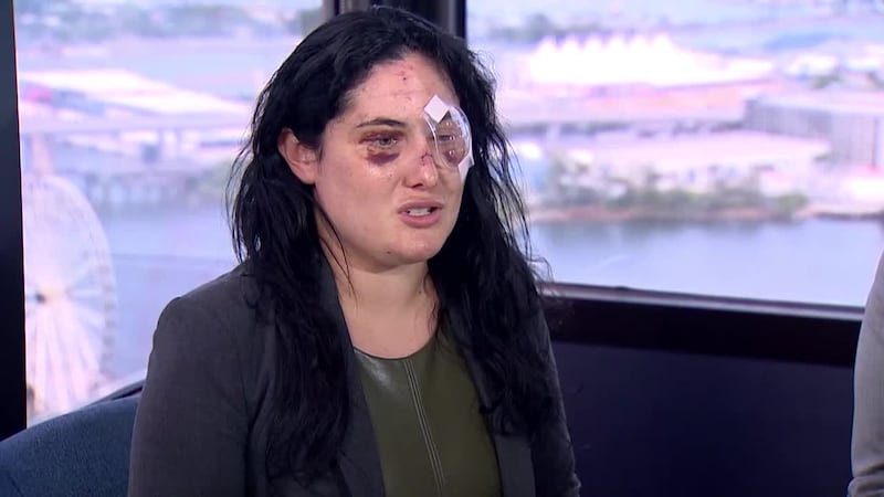 A woman who was attacked in an apparent random fit of rage outside her condo is sharing her...